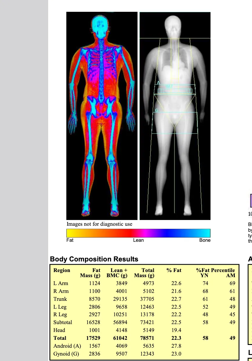 Dexa scan results
